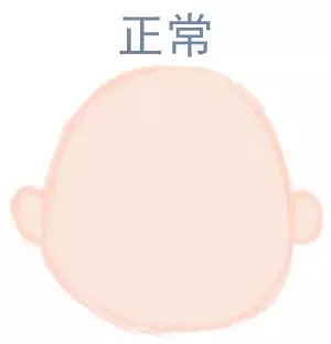 宝宝圆头好还是扁头好？这些奥秘好多爸妈都不知路5.webp.jpg